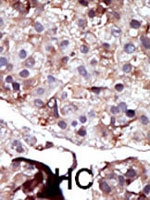 PAB2802 - Sphingosine kinase 2 / SPK2