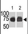 PAB2802 - Sphingosine kinase 2 / SPK2