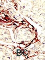 PAB2804 - STK11