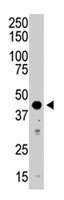 PAB2807 - Aurora kinase B