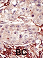 PAB2807 - Aurora kinase B