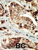 PAB2808 - STK16
