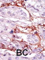 PAB2810 - STK31