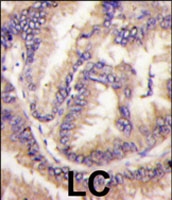 PAB2814 - CDKL5 / STK9