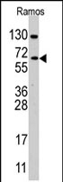 PAB2829 - CDC25B