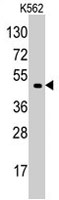 PAB2836 - EIF4A1