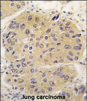 PAB2836 - EIF4A1