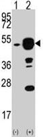 PAB2836 - EIF4A1