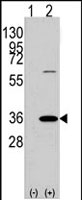 PAB2840 - Prohibitin-2