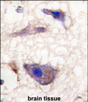 PAB2844 - Neuronal pentraxin-1