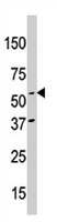 PAB2845 - APPBP1