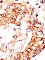 PAB2845 - APPBP1