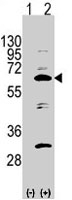 PAB2845 - APPBP1