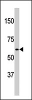 PAB2848 - APPBP2