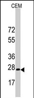 PAB2849 - BARX1