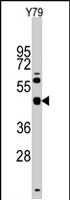 PAB2851 - TGIF1