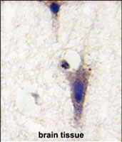 PAB2857 - LINGO1