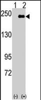PAB2861 - SPAG9 / JIP4