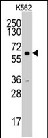 PAB2867 - Cyclin A2