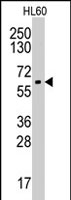 PAB2868 - Aromatase