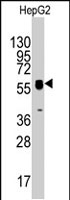PAB2870 - Thymidine phosphorylase (TYMP)