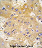 PAB2871 - Cytosol aminopeptidase