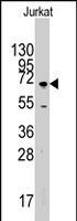 PAB2872 - MAPK4 / ERK4