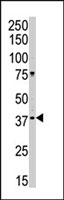PAB2874 - CSNK1A1