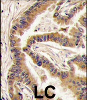 PAB2874 - CSNK1A1