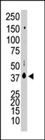 PAB2876 - Casein kinase I delta