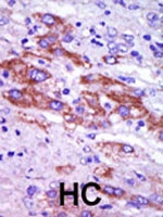 PAB2876 - Casein kinase I delta