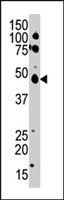 PAB2877 - Casein kinase I epsilon