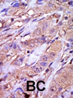 PAB2877 - Casein kinase I epsilon