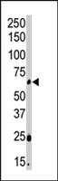 PAB2879 - CSNK1G2