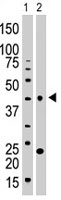 PAB2882 - VRK1