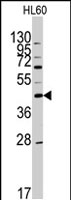 PAB2885 - Apolipoprotein A V / ApoA5