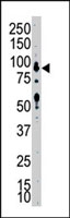 PAB2891 - MAPK7 / ERK5
