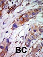 PAB2891 - MAPK7 / ERK5