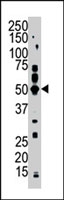 PAB2903 - PFTK2 / CDK15