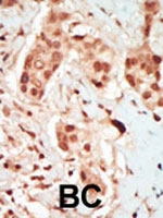 PAB2903 - PFTK2 / CDK15