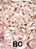 PAB2909 - CDK10