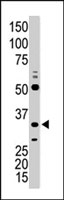 PAB2910 - CDK1