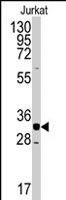 PAB2912 - CDK2
