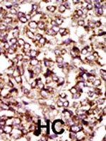 PAB2912 - CDK2