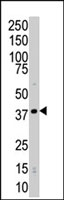 PAB2914 - CDK4