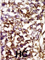 PAB2914 - CDK4