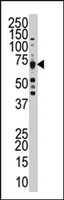 PAB2918 - CDK8