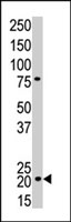 PAB2922 - CDKN1A / p21WAF1