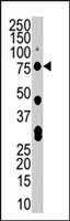 PAB2925 - CLK2