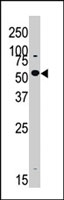 PAB2929 - DYRK2